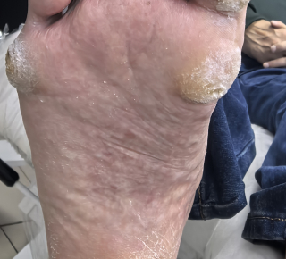 Педикюр с элементами подологии